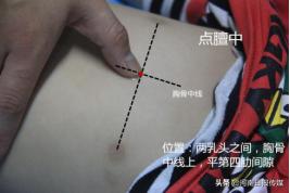 “疫”线中医｜中医外治疗法在治疗新冠肺炎中的应用