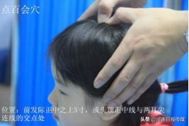 “疫”线中医｜中医外治疗法在治疗新冠肺炎中的应用